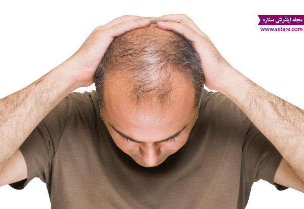 درمان ریزش مو با استفاده از گیاهی، تاثیر کم خونی بر ریزش مو