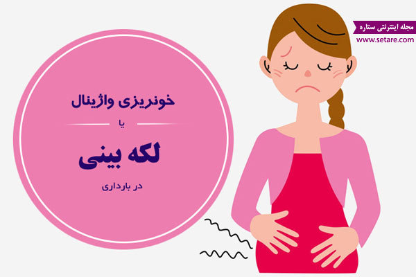 مصرف اشک مصنوعی در بارداری