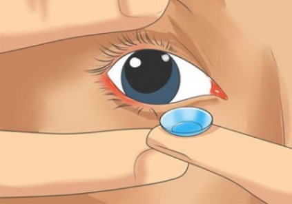 آموزش تصویری گذاشتن لنز در چشم آموزش تصویری گذاشتن لنز در چشم