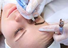 میکروپیگمنتیشن چیست و چه کاربردی دارد؟