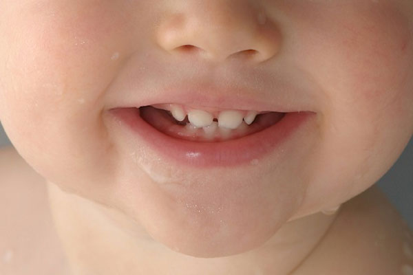 دندان شیری چیست و چه وظایفی دارد؟