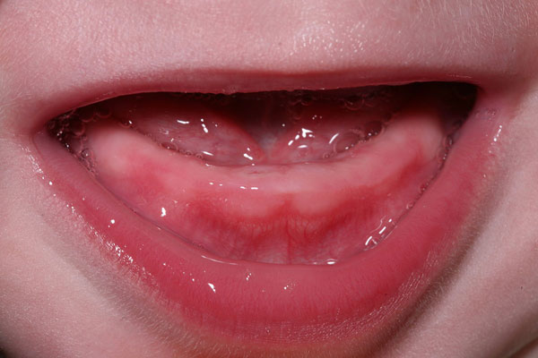 دندان شیری چیست و چه وظایفی دارد؟