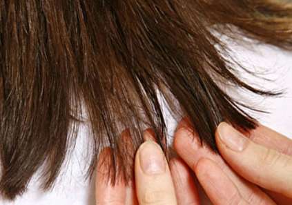پیشگیری از موخوره با ۹ روش موثر