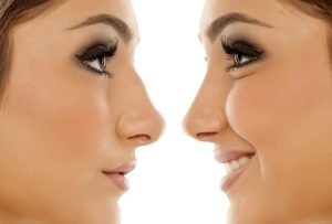 جراحی زیبایی بینی