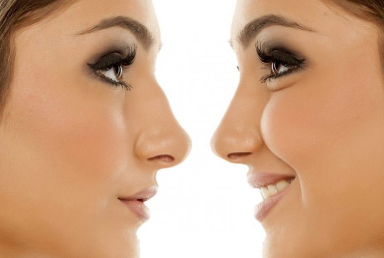 جراحی زیبایی بینی