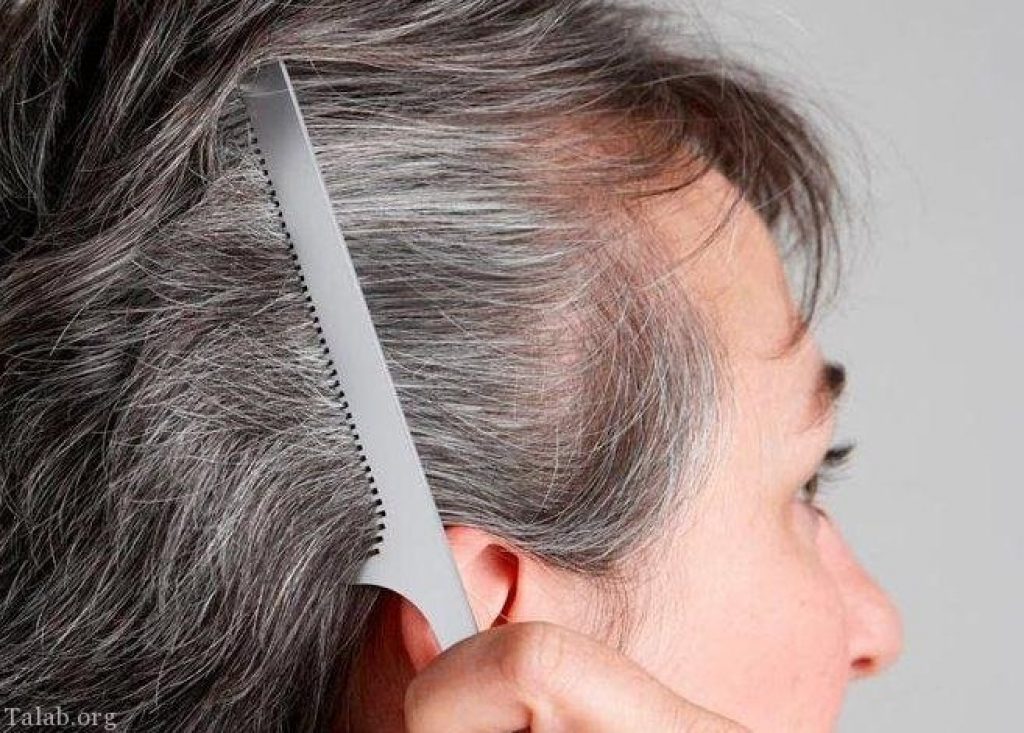 رفع سفیدی مو با درمان طبیعی