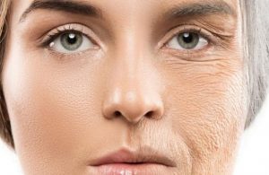 رفع چین و چروک های صورت با مواد طبیعی