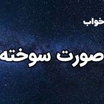 تعبیر خواب صورت سوخته