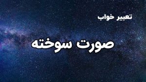 تعبیر خواب صورت سوخته