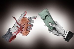 حکم شرعی فروش کلیه