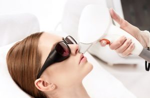 لیزر پوست صورت