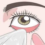 بهترین پماد چشمی استریل