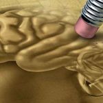 علائم آلزایمر