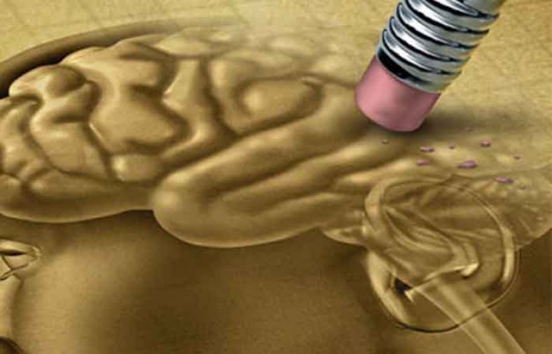 علائم آلزایمر