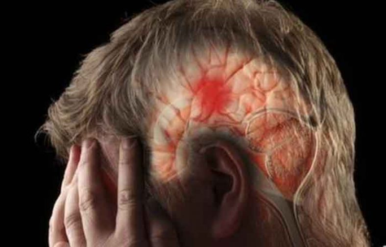 سکته مغزی خفیف