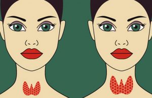 قرص تیروئید برای کم کاری تیروئید