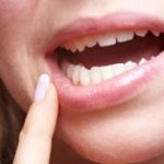 قرص برای عفونت دندان