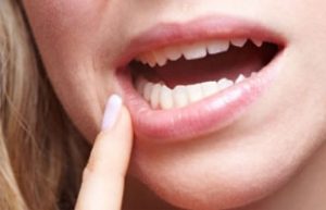 قرص برای عفونت دندان
