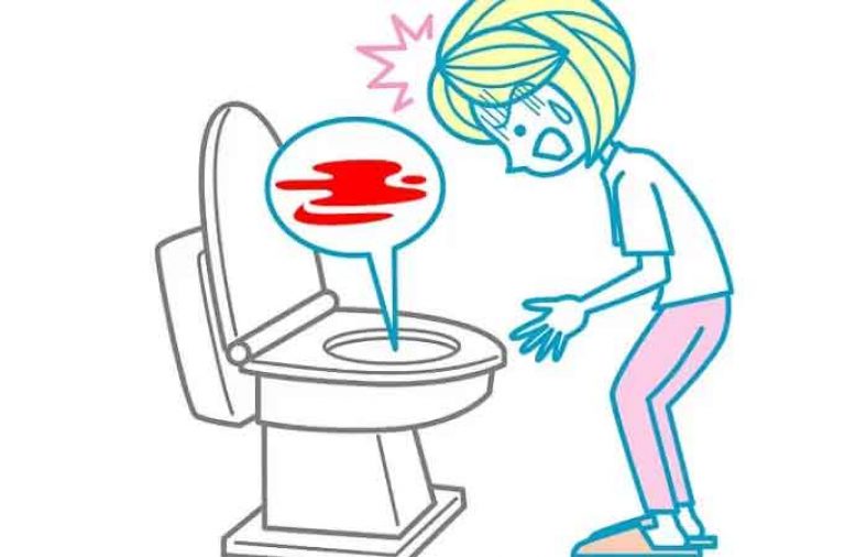 وجود خون در مدفوع