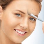 ژل بنزوئیل پروکساید