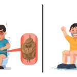 درمان یبوست شدید