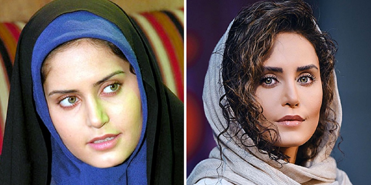 عکس الناز شاکردوست قبل عمل