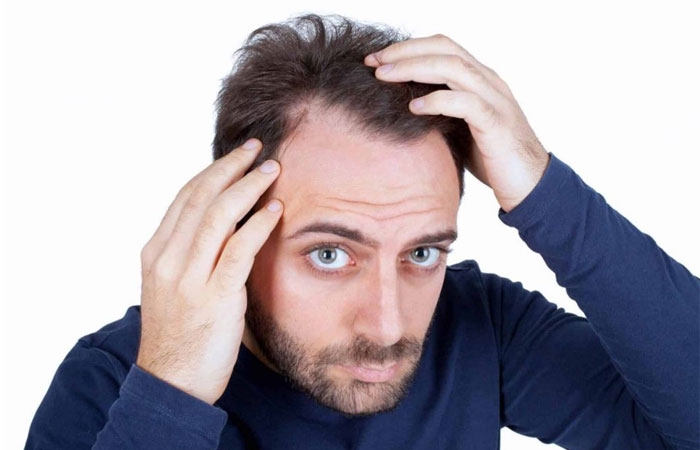 معرفی قرص فیناگرو؛ دارویی برای درمان ریزش مو - ستاره
