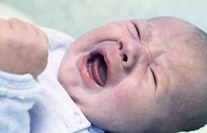 سیانوز در نوزادان