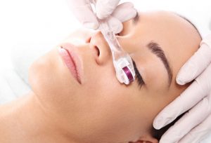 میکرونیدلینگ خانگی