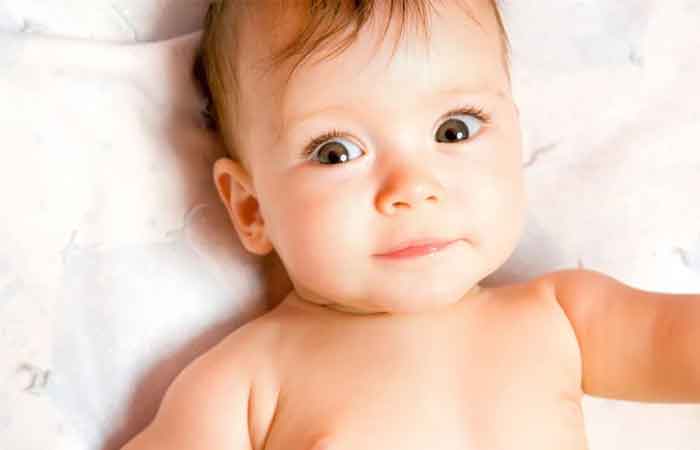 انحراف چشم در نوزادان