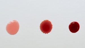 لکه بینی در بارداری