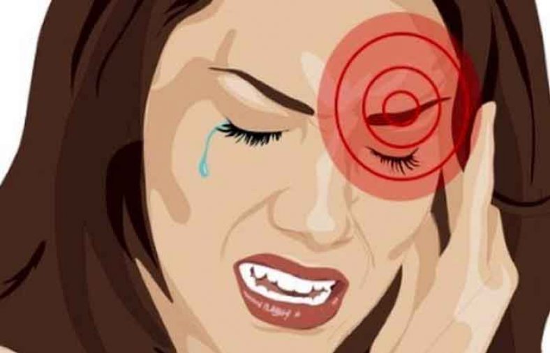 علائم میگرن چشمی