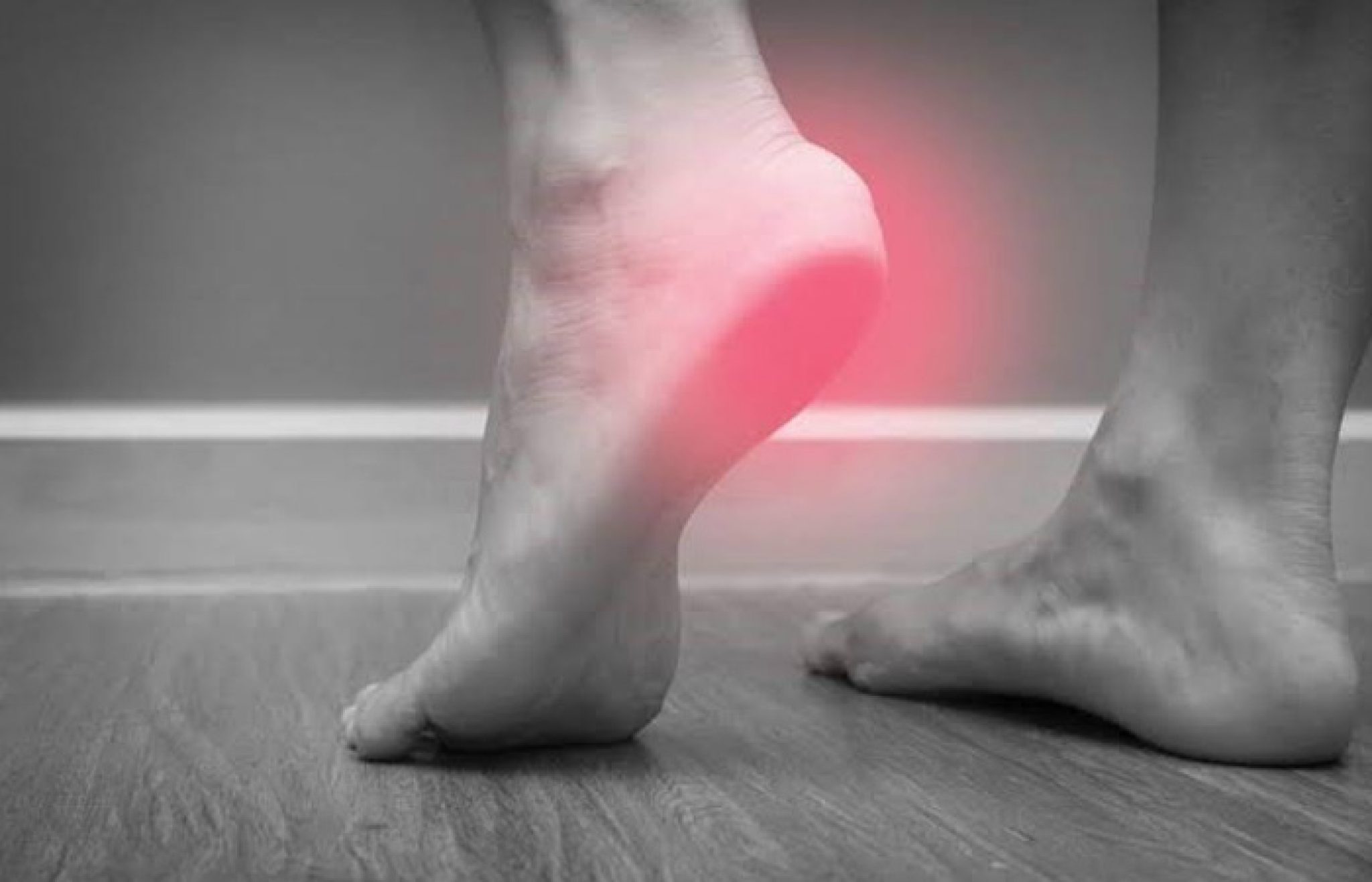 درمان خار پاشنه در خانه با