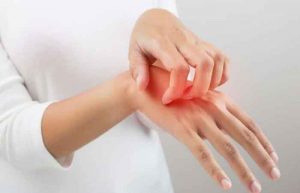 آلرژی پوستی