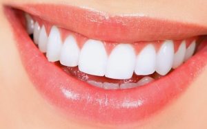 اصلاح طرح لبخند