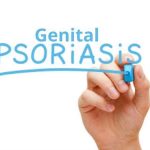 پسوریازیس تناسلی