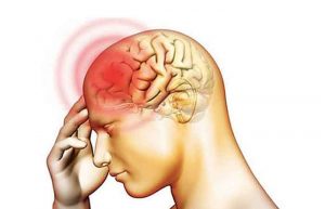 علائم مننژیت