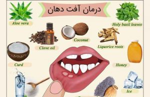 درمان سریع آفت دهان