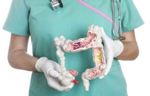 علائم کولیت روده