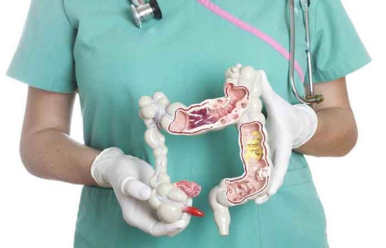 علائم کولیت روده