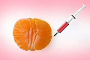 تزریق چربی به واژن