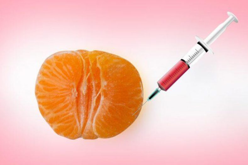 تزریق چربی به واژن