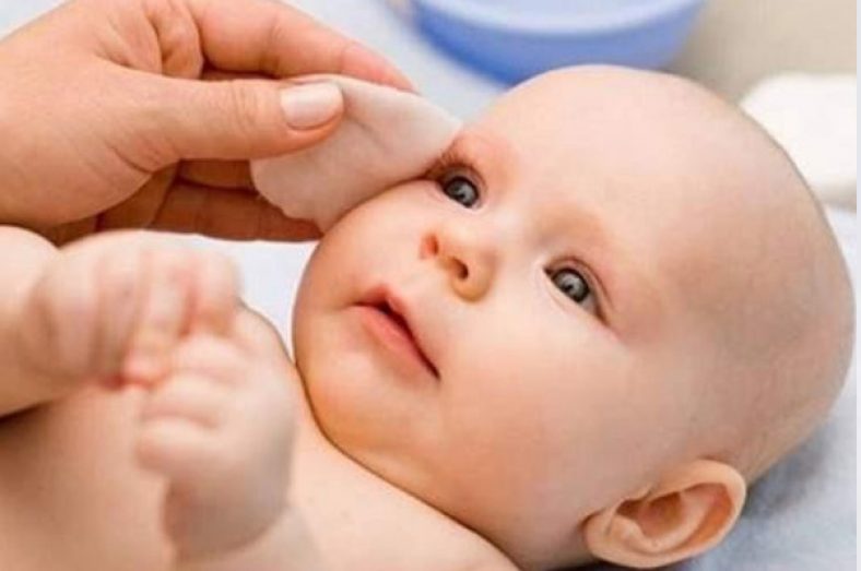 علت آبریزش چشم نوزاد