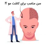 سن مناسب برای کاشت مو در آقایان و بانوان