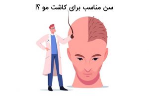 سن مناسب برای کاشت مو در آقایان و بانوان
