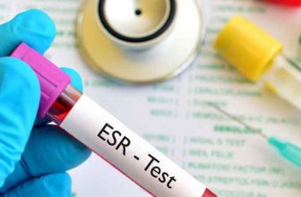 تست ESR آزمایش خون