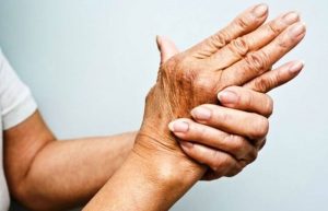 قرص هیدروکسی کلروکین