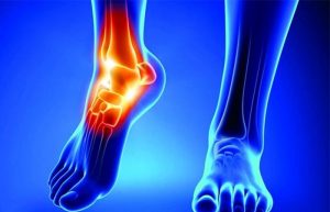 داروی هیالورونات سدیم