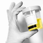 مخاط یا Mucus در آزمایش ادرار