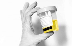 مخاط یا Mucus در آزمایش ادرار
